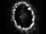 ring around supernova 1987A
